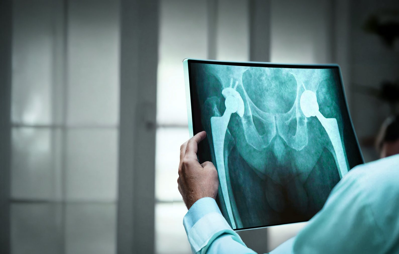 Médico analisa radiografia de quadril com prótese total bilateral